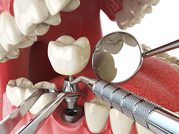 Best After-Hours Dental Trauma Care in Druid Hills, GA
